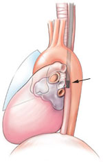heart diagram